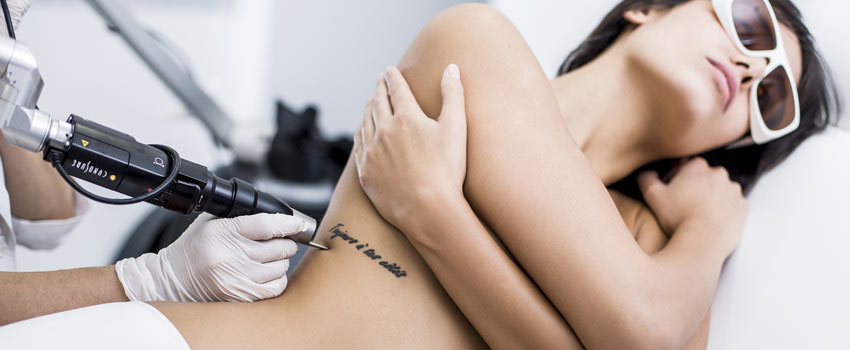 Frau lässt sich Tattoo entfernen