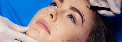 Frau auf dem Behandlungstisch mit angezeichneten Linien im Gesicht