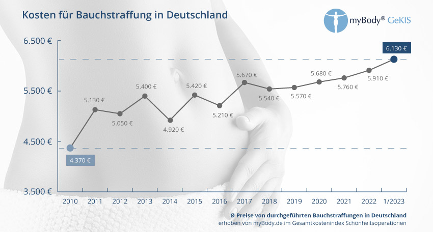Preisentwicklung Bauchstraffung in Deutschland