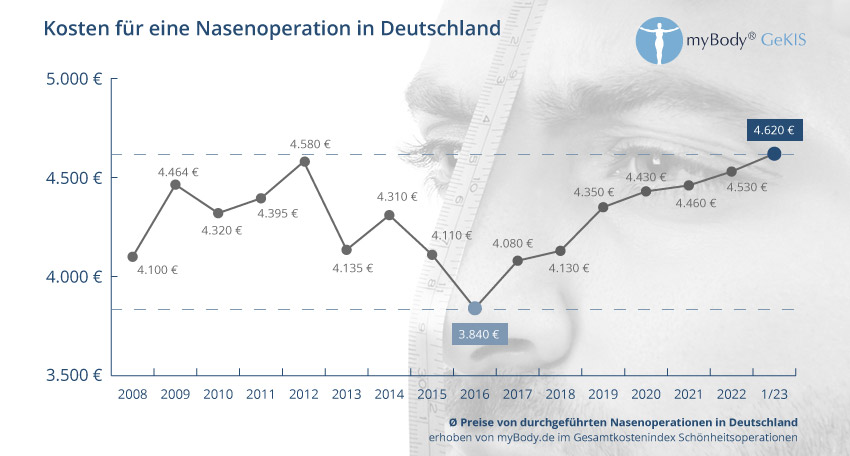 Diagramm Preisentwicklung Nasenoperation in Deutschland