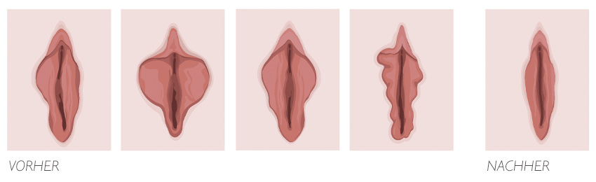 Ist venushügel wo der Vulva