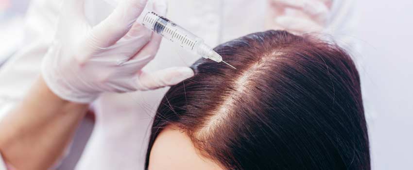 Frau bekommt Haarausfall-Injektion am Scheitel