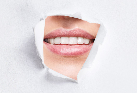 Lächeln mit weißen Zähnen sichtbar durch Loch in Papier