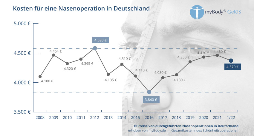 Diagramm Nasenoperation Kosten
